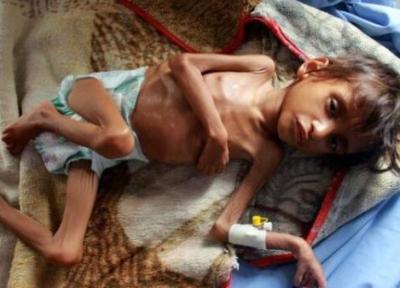 هشدار برنامه جهانی غذا درباره سطح بی سابقه گرسنگی در یمن